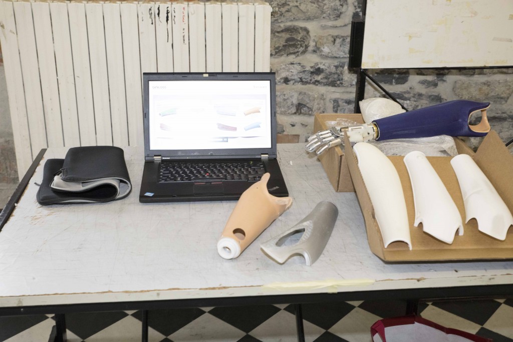 3dprinted-prosthesis