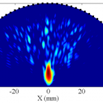 Ultrasound B-Mode Image Reconstruction 